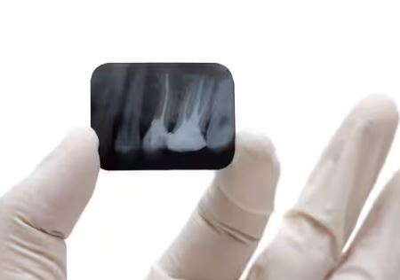 Rayos X Dental
